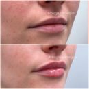 Joocy Lips