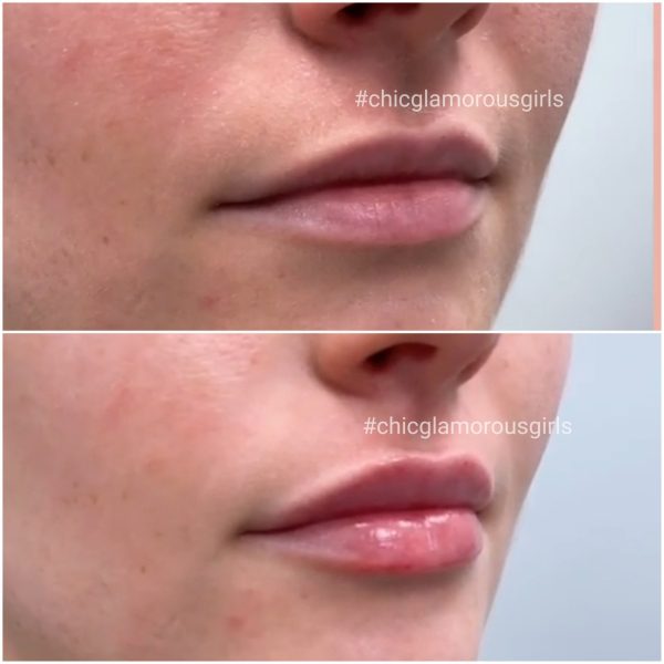 Joocy Lips
