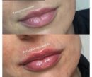 Joocy Lips