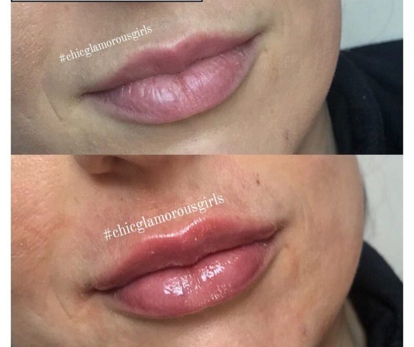 Joocy Lips