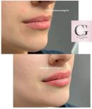 Joocy Lips