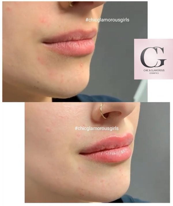 Joocy Lips